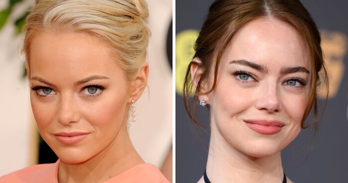 Oops! Celeb Tan Fails That’ll Make You Do a Double Take