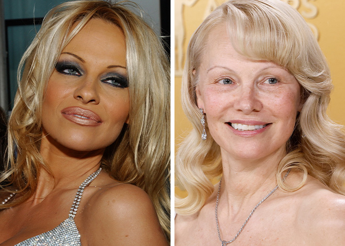 Pamela Anderson’s 'Did She Go Too Far?' Tan