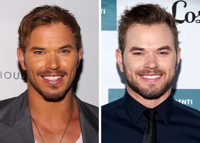 Kellan Lutz’s Tanning Adventure Gone Wrong