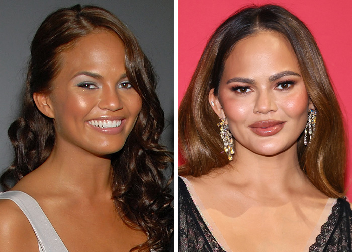 Chrissy Teigen’s 'Oops, Did I Tan Too Much?' Moment