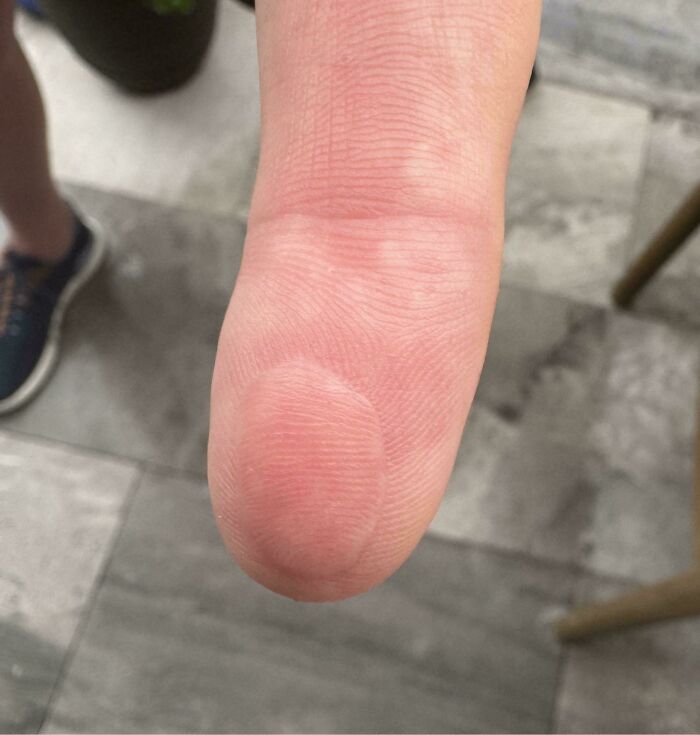 Whoops! Finger Pad Got Put on Backwards