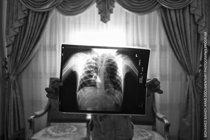 Moon Dust: Toxic Cement and Sick Kids in Egypt