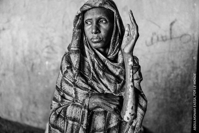 Sudan’s Nightmare: War and Displacement