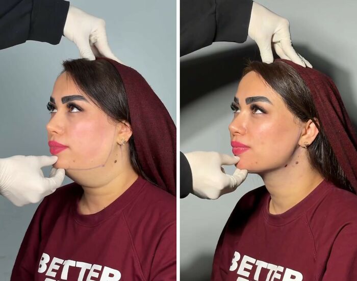 Wait Till You See These Jawline Transformations That Are Totally Mesmerizing (31 Pics)