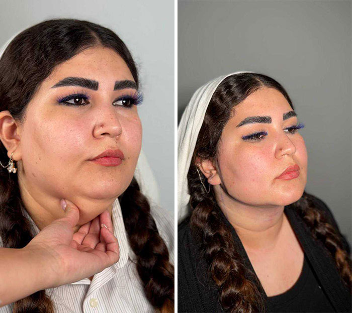 Wait Till You See These Jawline Transformations That Are Totally Mesmerizing (31 Pics)