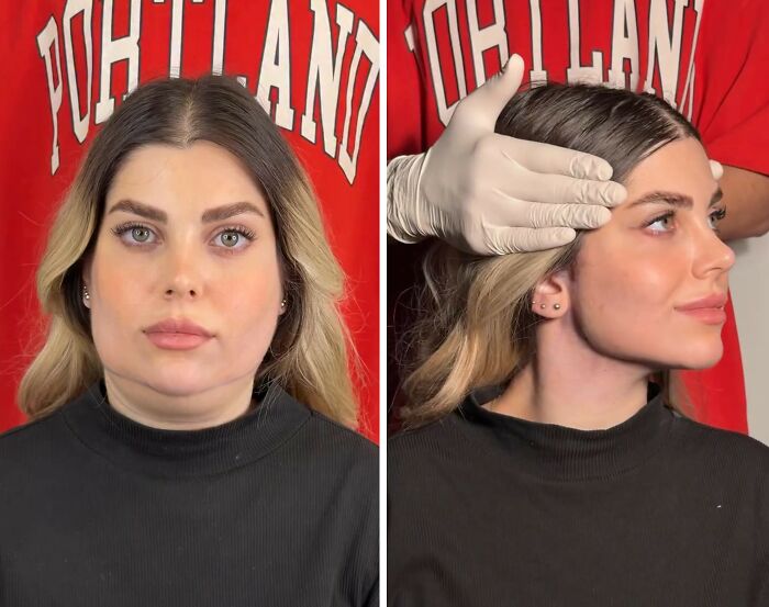 Wait Till You See These Jawline Transformations That Are Totally Mesmerizing (31 Pics)