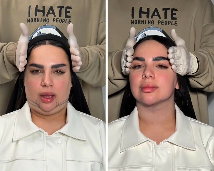 Wait Till You See These Jawline Transformations That Are Totally Mesmerizing (31 Pics)