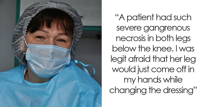 The Wildest Gross-Out Stories Medical Pros Swear Are Real