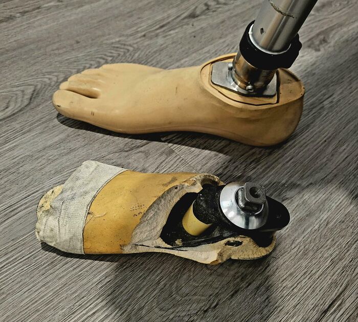 New Prosthetic Foot Shell vs. The One That Served Me Two Years