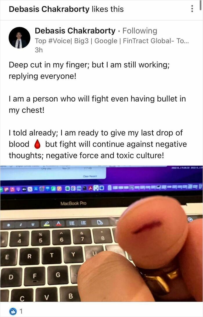 Wait, They Really Posted This on LinkedIn? Prepare to Cringe (and Laugh!)