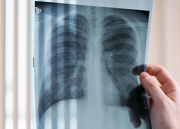 65 Things Emergency Workers Swear They'll Never Do Again (And They're So Not Kidding)