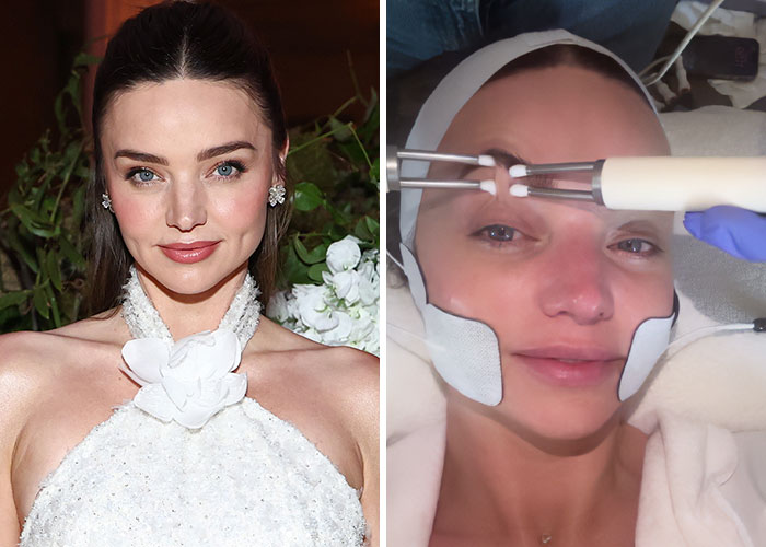 Miranda Kerr: Yoga Face or Secret Weapon?