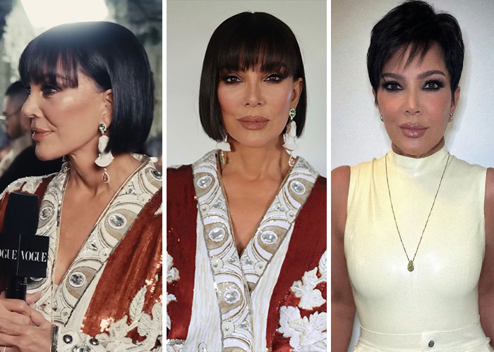Kris Jenner: Facelift Queen or Nose Drama?