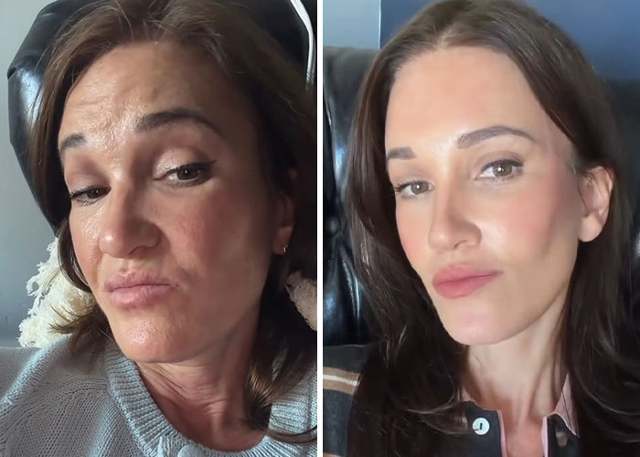 Katie Anderson - Round Two Facelift