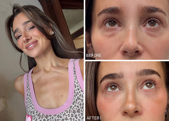 Danielle Bernstein - Bye, Puffy Bags!