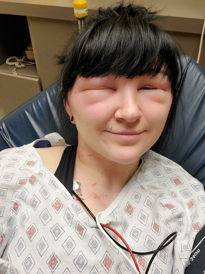 Guess Who’s Allergic To Hair Dye? Spoiler: This Girl