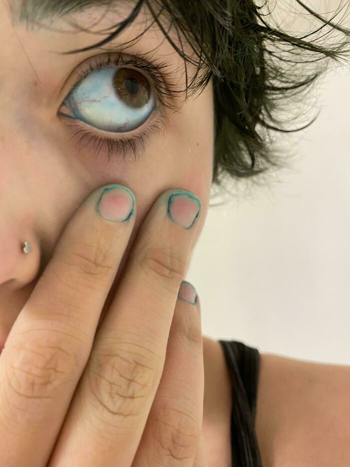 Dyed Everything But Hair—Tongue, Nails, Even Eyes?