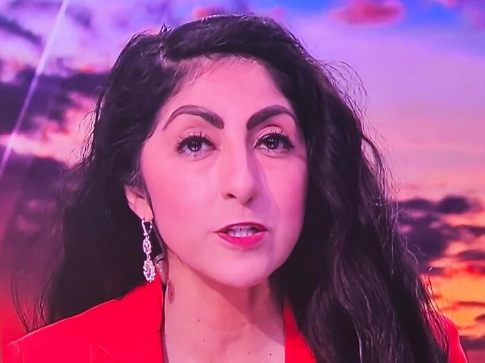 What Did They Do To This News Reporter’s Hair?