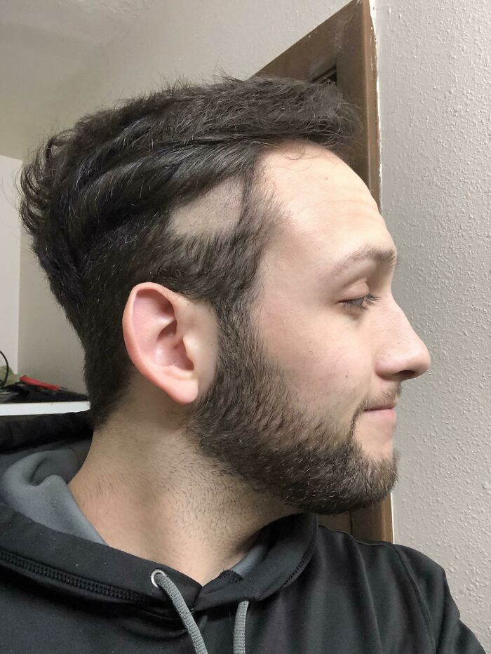 Tried Cutting My Own Hair But My Clippers Had Other Plans