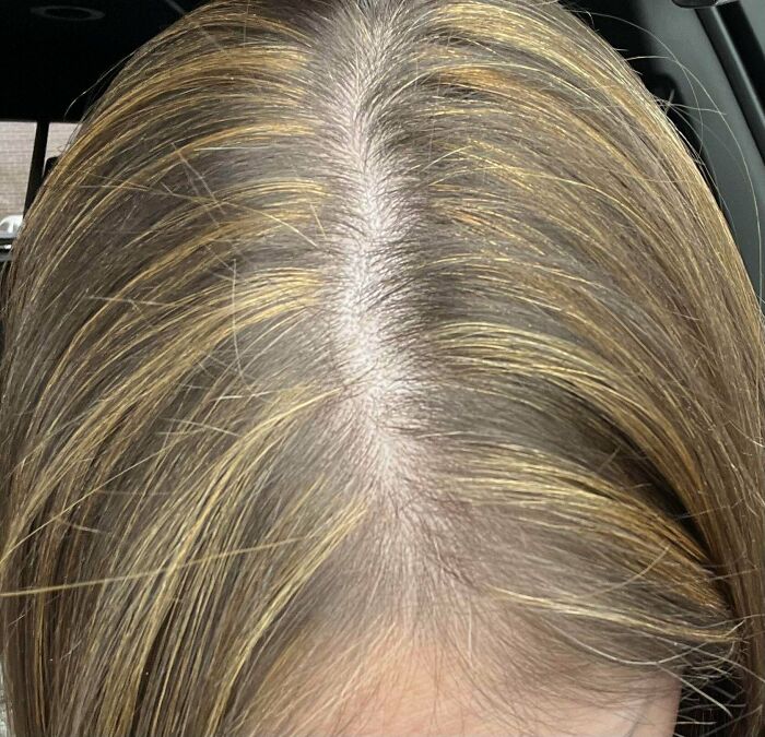 Highlight Disaster: Yellow Chunky Madness