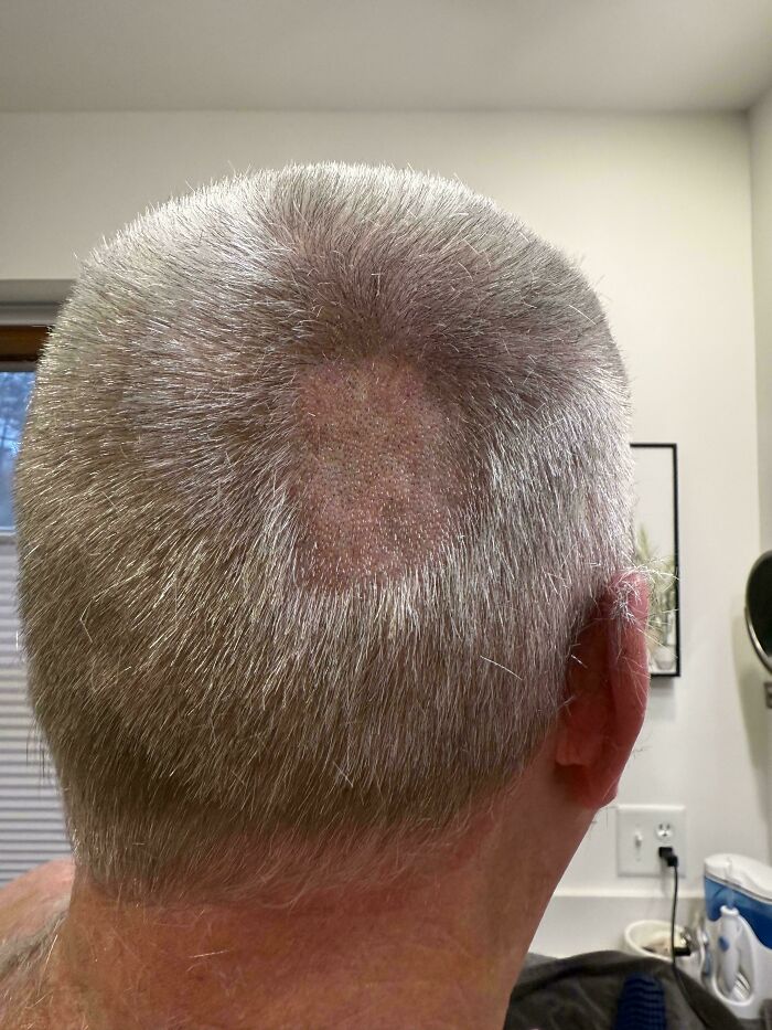 Cut My Own Hair For Years, This Morning Broke The Streak