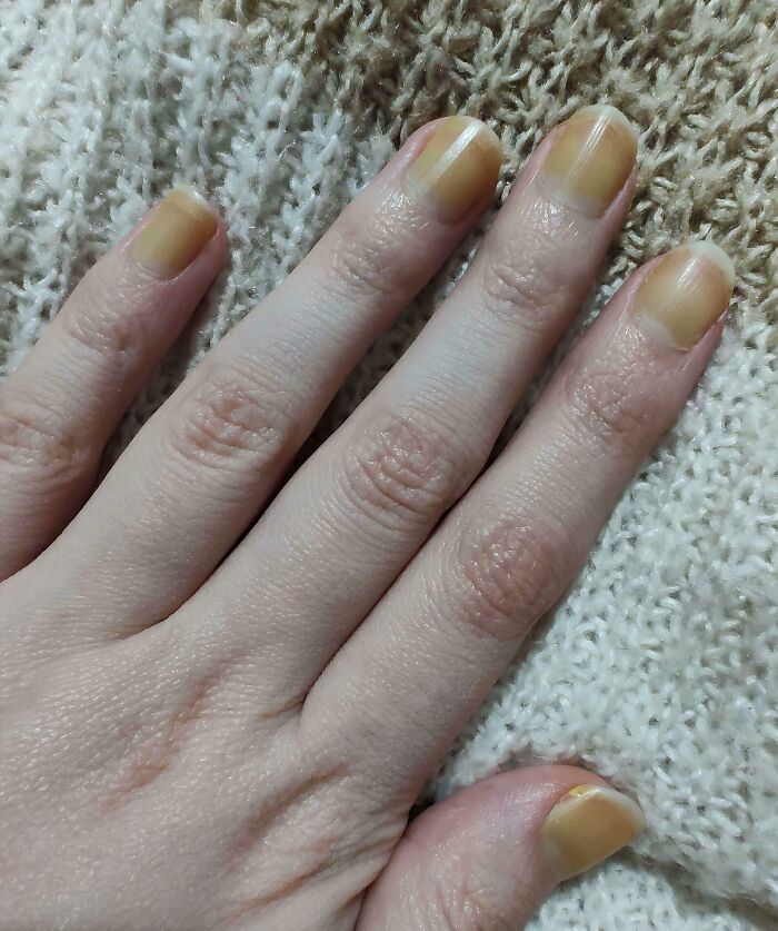 Yellow Nail Polish Disaster Alert! Don’t Try This At Home