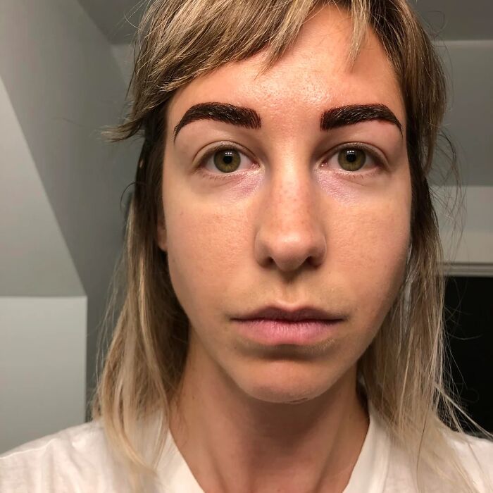 Face Of Regret: 12 Hours After Microblading