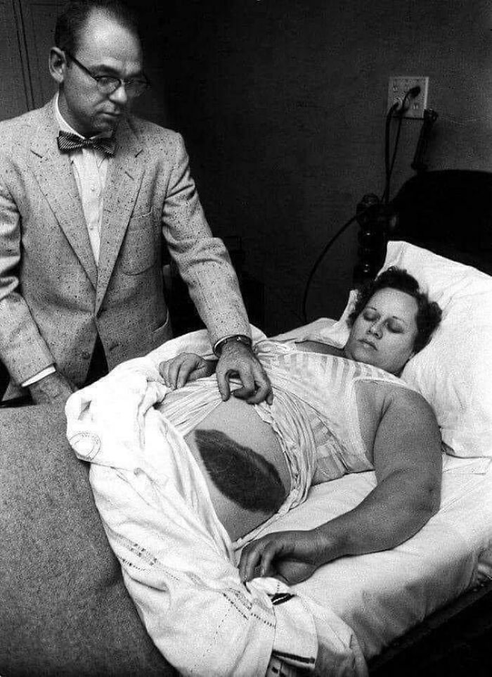 Ann Hodges—The Only Person Ever Hit By a Meteorite (And Lived to Tell the Tale)