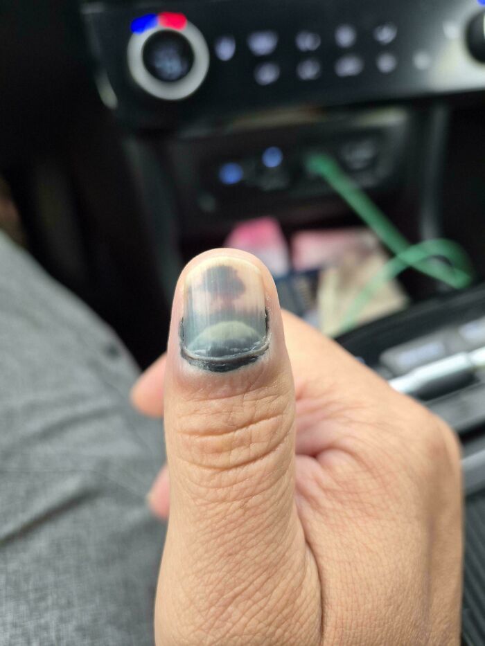 41 Hilarious Things That Look Like Other Things (Bet You Didn’t See That Coming!)