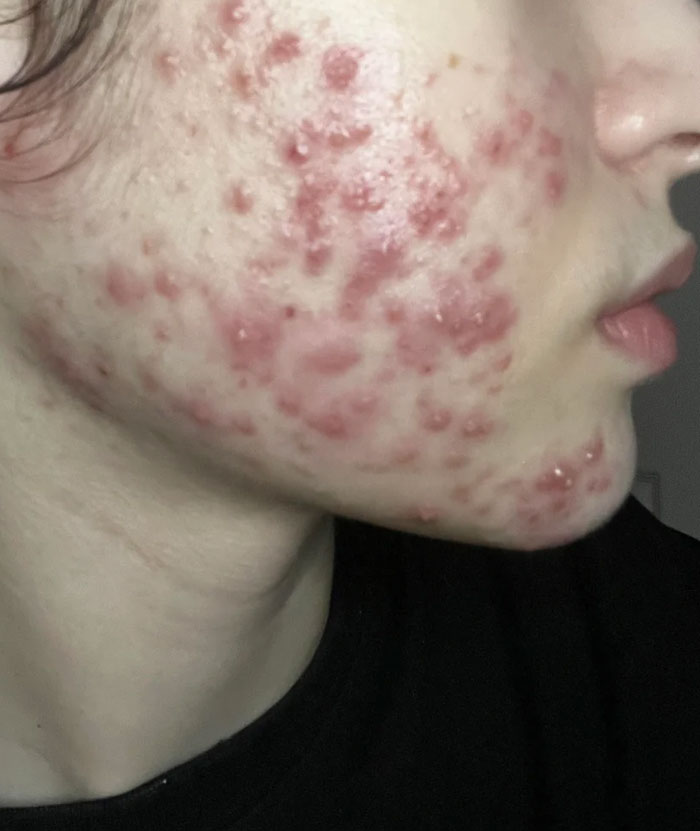 Let's Spill The Tea On Beauty Myths That Had Us Fooled Forever