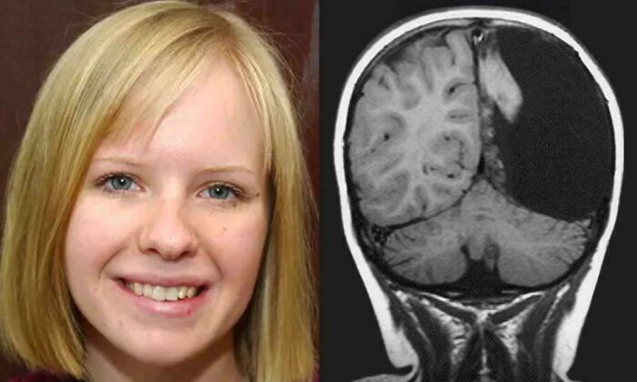 Kid Had Half Her Brain Removed At 8 To Stop Seizures, Then Became A Speech Pro And Total Boss