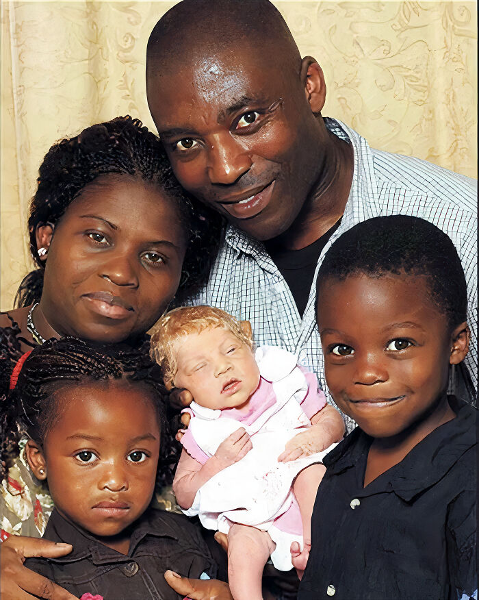 Black Nigerian Parents Had A Blonde, Blue-Eyed Baby in London—Genetics Said Huh?