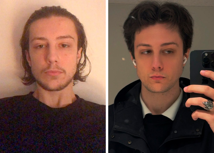 Wait, People Are Totally Owning The 2020 vs 2026 Glow-Up Challenge!