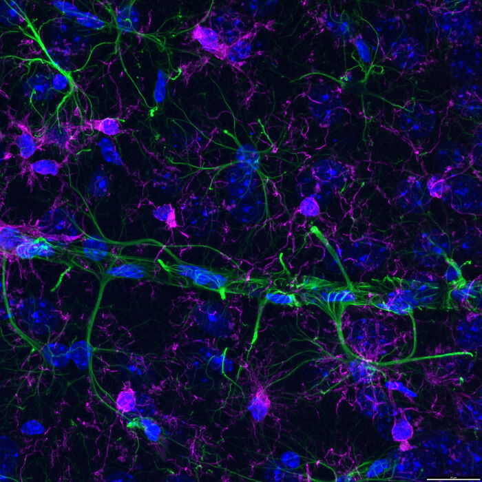 “Fluorescent Brain Tissue From An Alzheimer’s Mouse” — Bettina Rákóczi