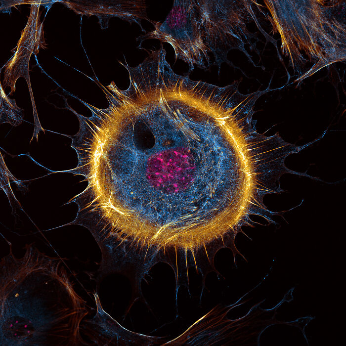 “Mouse Embryonic Fibroblast” — Joe Mckellar