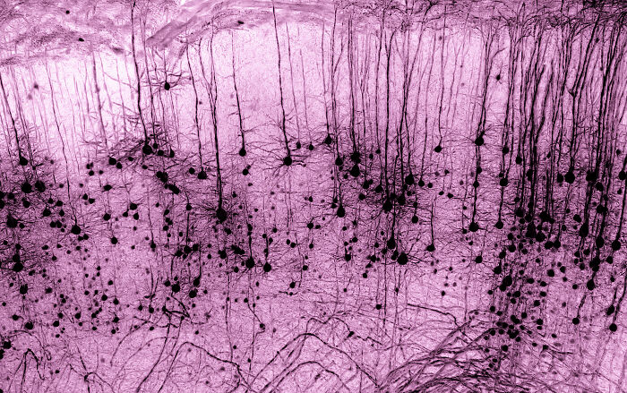 “GFP-Positive Thy1 Neuron In A Mouse Brain” — Marko Pende