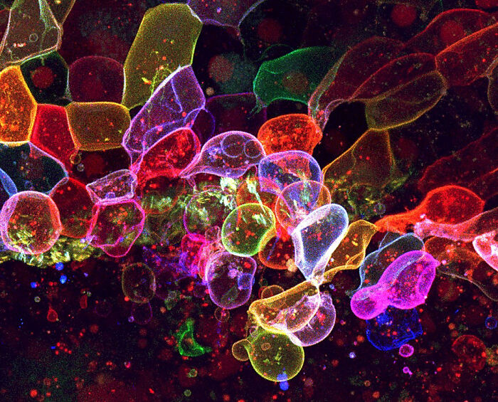 “Dying Cells During Osmotic Stress” — Yue Rong Tan