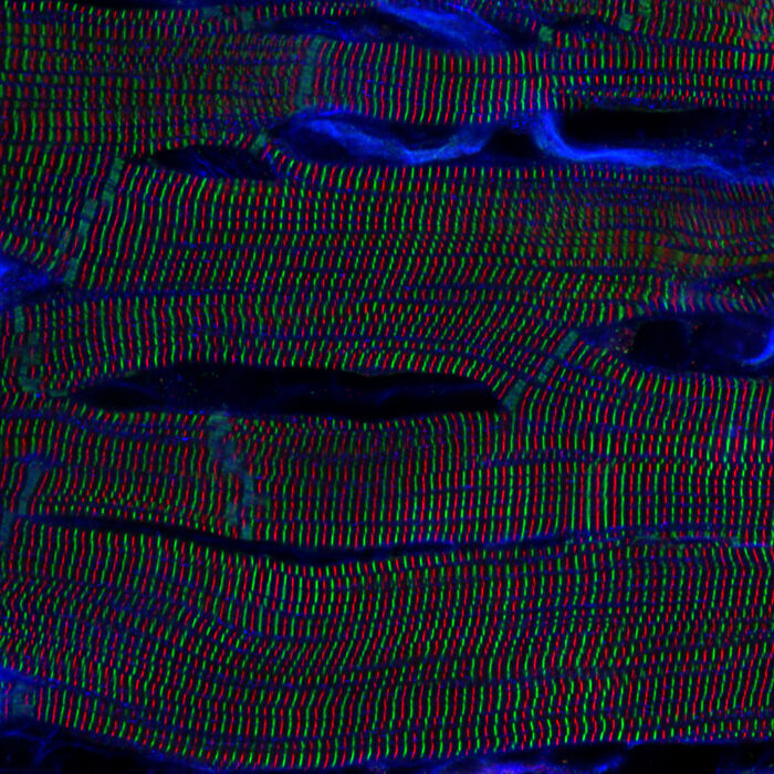 “Sarcomere Structures In Rat Heart” — Kentauro Mochizuki