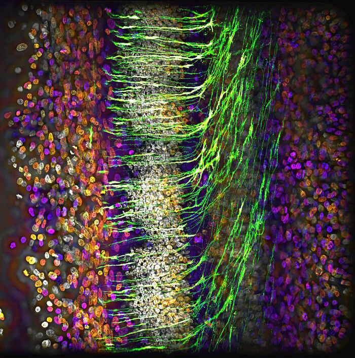 “Nerve Fibers In A Developing Chick Embryo” — Alexandre Dumoulin