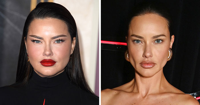 Wait, Did They Really Go for That? 18 Celebs and Their Mysterious ‘Face Sculpts’