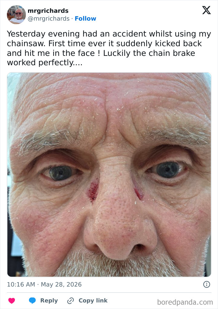 Whoa! Dodged Disaster With Protective Face Shield