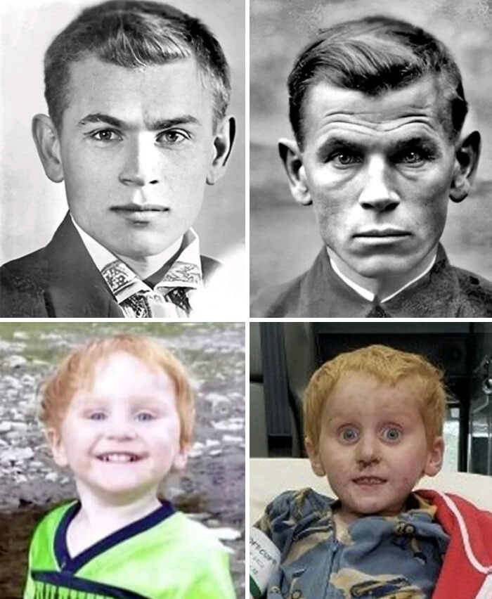 "The Thousand-Yard Stare": When Your Brain Just Can’t Even