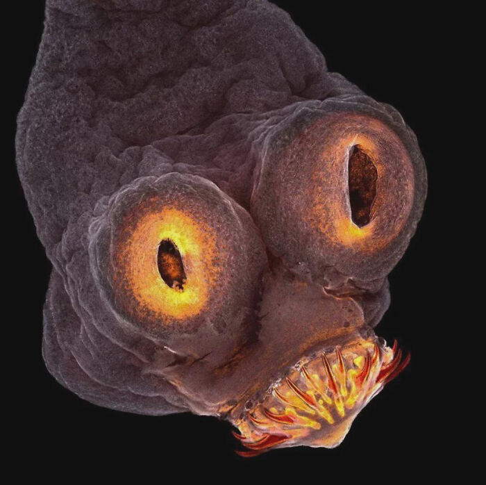 Pork Tapeworm Up Close at 200x Magnification. Yes, Really.