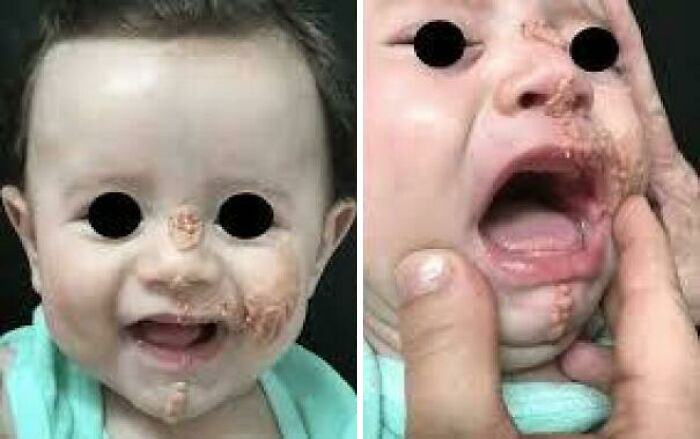 Patient Identity Censored with a Face Like a Sci-Fi Mask—Creative and Weird!