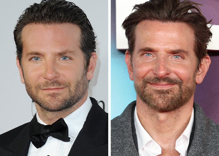 Bradley Cooper: ‘No Surgery Here!’ (According to Friends)