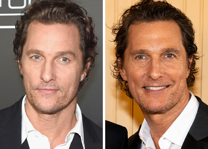 Matthew McConaughey: Weight Loss or Surgery Shenanigans?