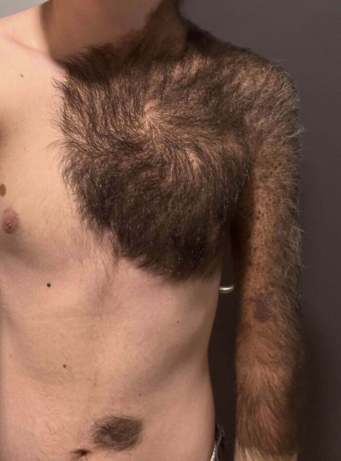Wait, People Actually Shared These Wild Body Pics?! 61 Absolutely Mind-Blowing Shots