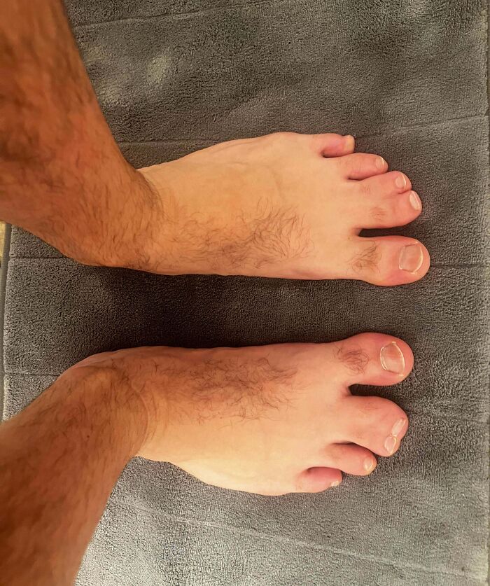 Wait, People Actually Shared These Wild Body Pics?! 61 Absolutely Mind-Blowing Shots