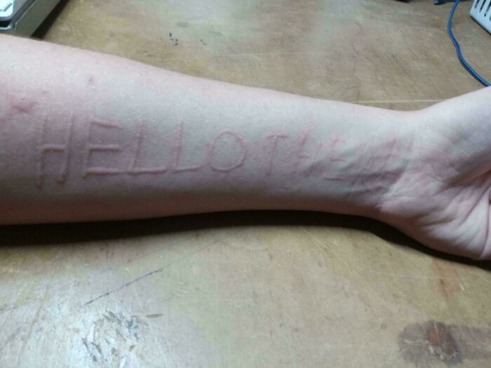 Wait, People Actually Shared These Wild Body Pics?! 61 Absolutely Mind-Blowing Shots