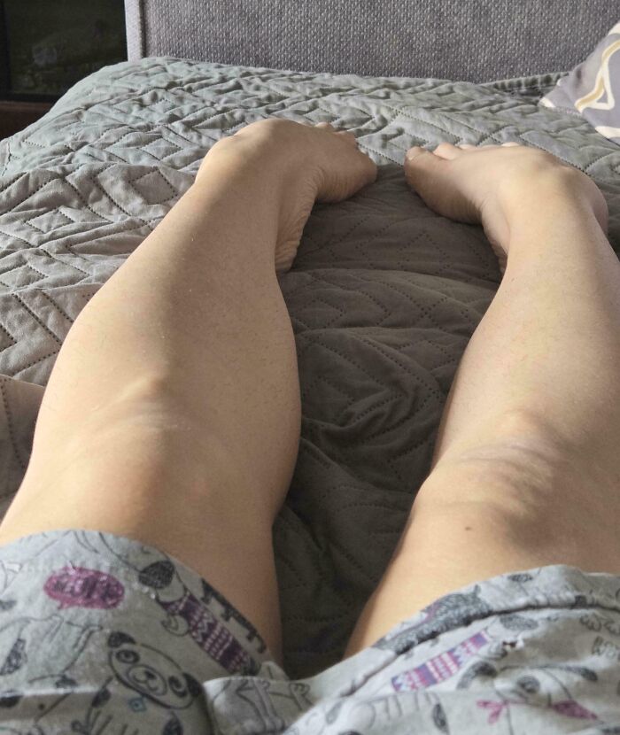 Wait, People Actually Shared These Wild Body Pics?! 61 Absolutely Mind-Blowing Shots